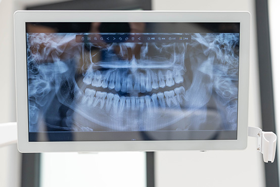 Southern Connecticut Oral   Maxillofacial Surgery   Implantology