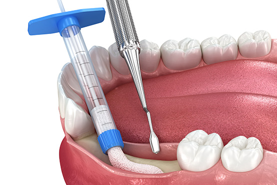 Southern Connecticut Oral   Maxillofacial Surgery   Implantology